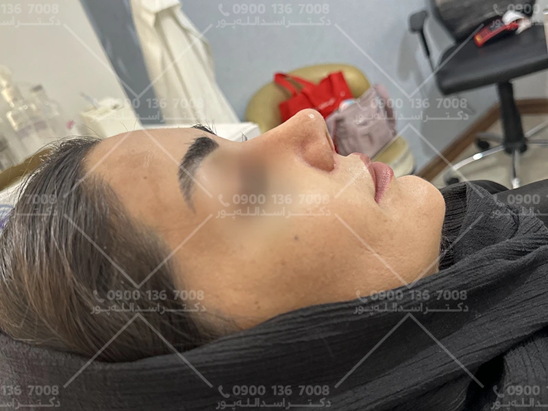 نمونه کارهای دکتر اسدالله پور جراح بینی قائمشهری